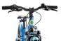 SCool XXlite alloy 20-7 28 cm | blue/petrol | 20 Zoll